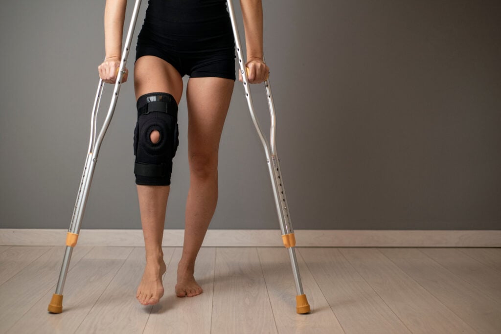 How Long Does ACL Recovery Take