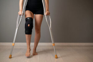 How Long Does ACL Recovery Take