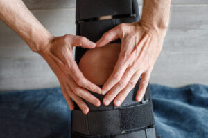 What Should You Do the First Week After an ACL Tear